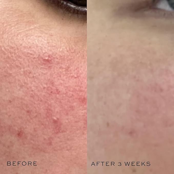 DIME Beauty Super Skin Toner, Alcohol-Free Witch Hazel Toner, Hydrating Toner for Face with Aloe Vera and Cucumber Extract, 4 oz / 120 ml-FemmiqueWomen