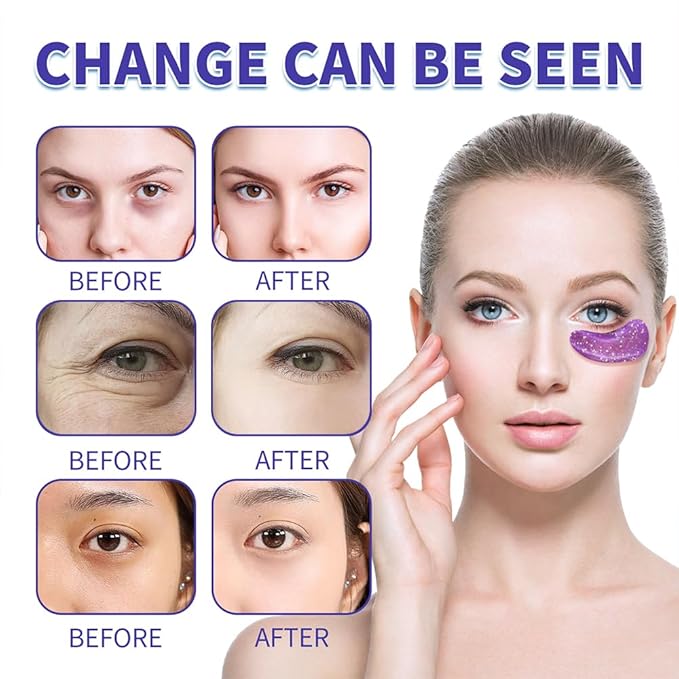 28 Pairs Under Eye Patches, Natural Collagen Eye Patches for Puffy Eyes, Under Eye Mask Patches for Face, Reduce Dark Circles, Fine Lines and Puffiness, Refreshes Your Skin, Eye Moisturizer Treatment-FemmiqueWomen