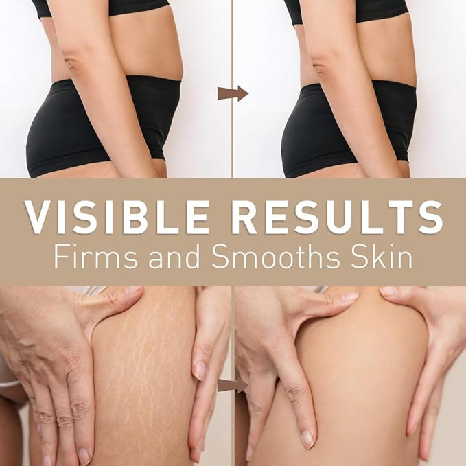 Belly Firming Cream: B Flat Skin Tightening Cream , Cellulite & Stretch Mark Reduction & Tummy Hips Cream & Body Firming for Stomach & Thighs & Arms – 3.38 Fl Oz-FemmiqueWomen