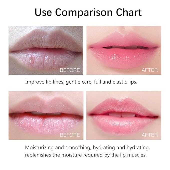 20Pcs Moisturizing/Plumping Lip Mask, Restores Moisture Mask for Dry Lips and Lines Overnight Care, Gel Treatment Masks (Pink)-FemmiqueWomen