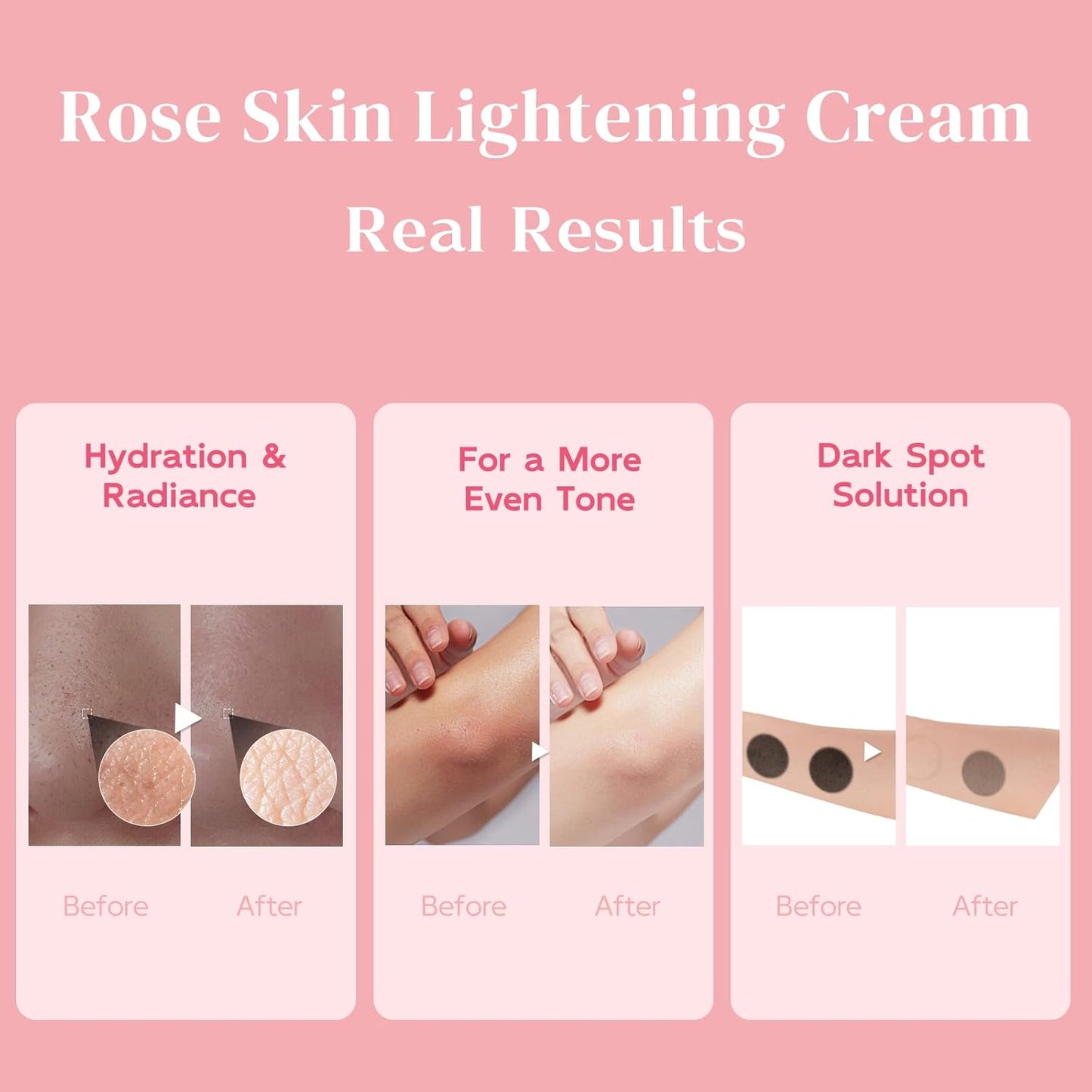 Underarm Lightening Cream - Skin Lightening Cream - Intimate Areas, Inner Thigh, Armpit, Dark Elbows and Knees, Bikini Areas, Underarm, Private Parts, 1.69 fl.oz-FemmiqueWomen