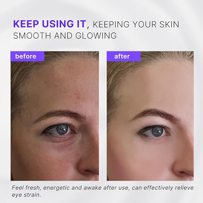 2-in-1 Eye Cream Applicator and Ice Roller, Face Massager Tool for Puffiness, Eye Bags, Muscle Ache-FemmiqueWomen