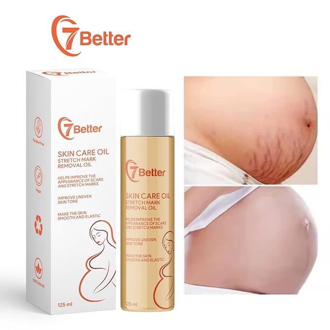 Stretch Mark Pregnancy Oil, Natural Oil Skincare Body Oil Serum for Scars and Stretch Marks, Face with Vitamin E & A for Sensitive Dry Skin and Body Moisturizer-FemmiqueWomen