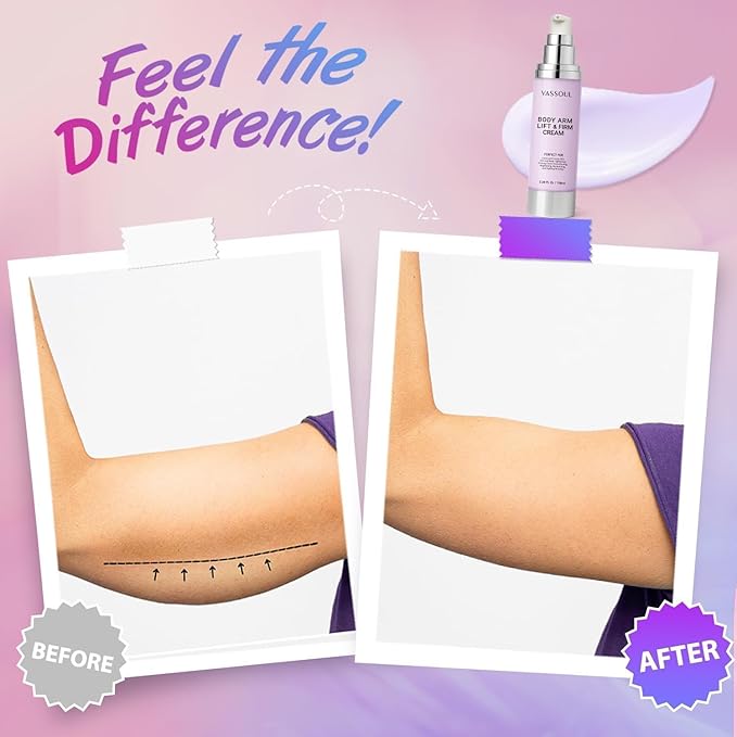 VASSOUL Lift and Firm Arm Cream : Skin Tightening Cream for Body - Firms Loose Skin, Reduces Cellulite on Arms, Thighs & Butt – 100ML-FemmiqueWomen