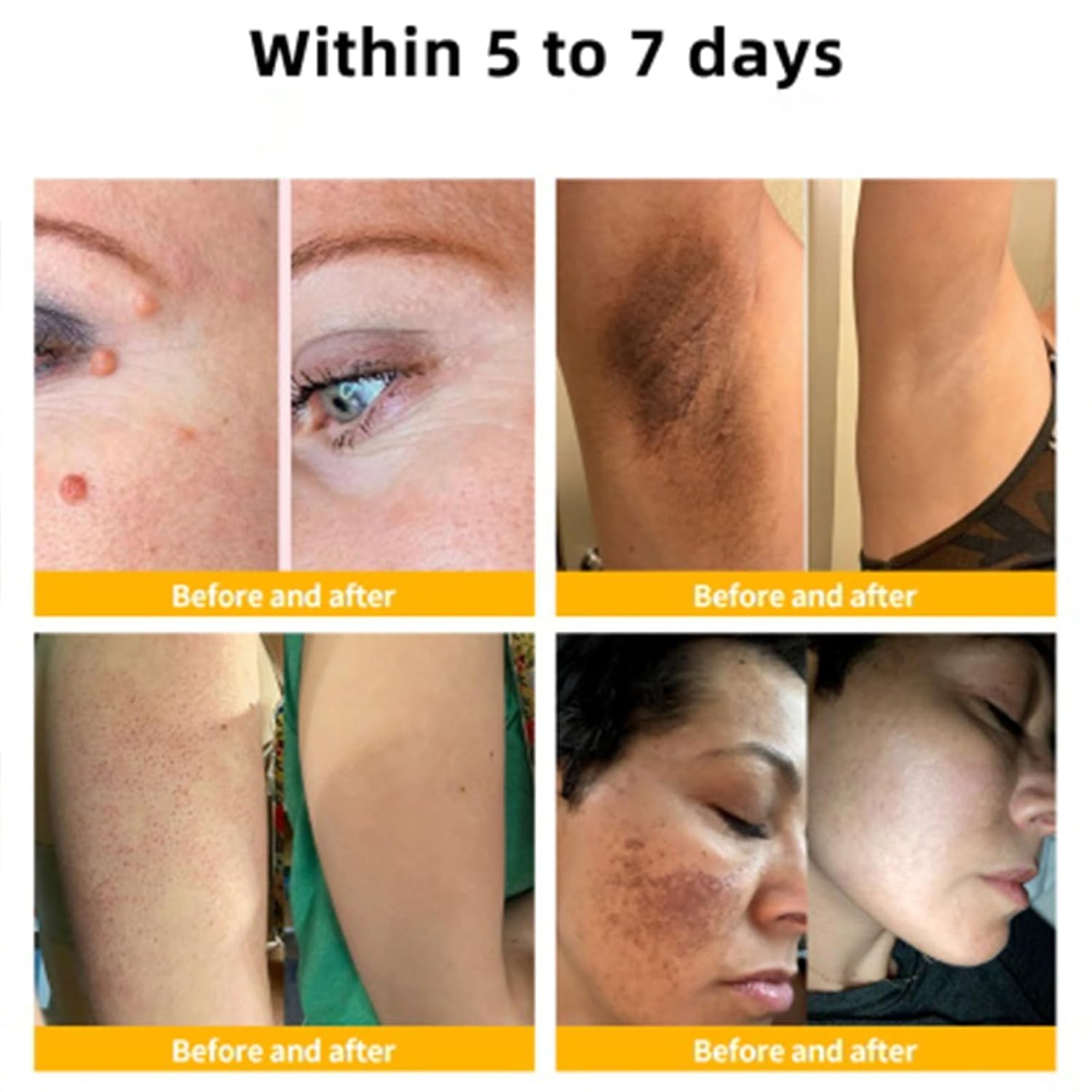 Bee Venom Cream, Professional Bee Venom Cream, Bee Venom Repair Cream for All Parts of The Body (2 Pack)-FemmiqueWomen