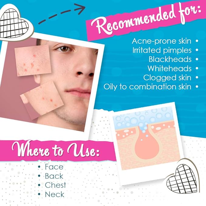 Bye Bye Blemish Acne Drying Lotion, On-the-Spot Pimple Treatment, Reduce Pimples Overnight, Beauty Skincare Essential - 1oz. (2-Pack)-FemmiqueWomen