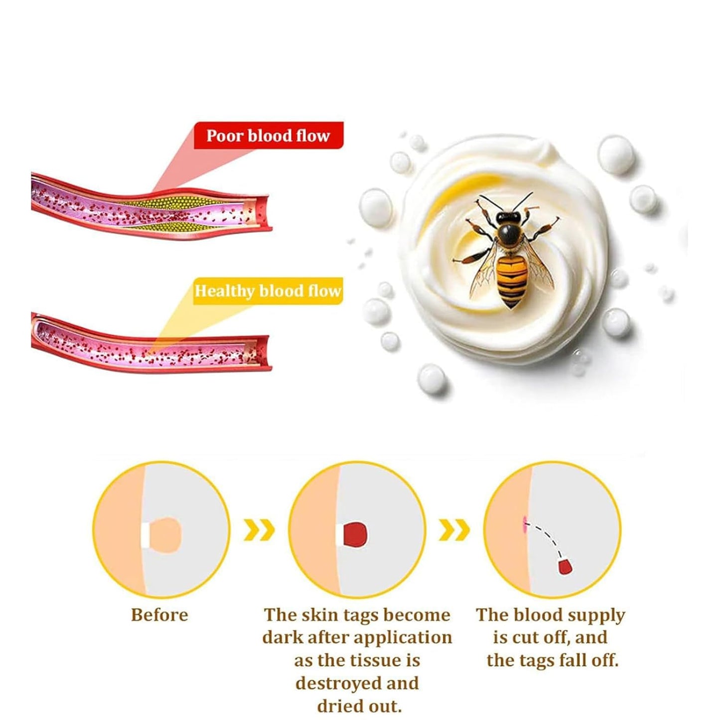 Bee Venom Skin Treatment Cream, Bee Venom Repair Cream, Suitable for All Skin Types-FemmiqueWomen