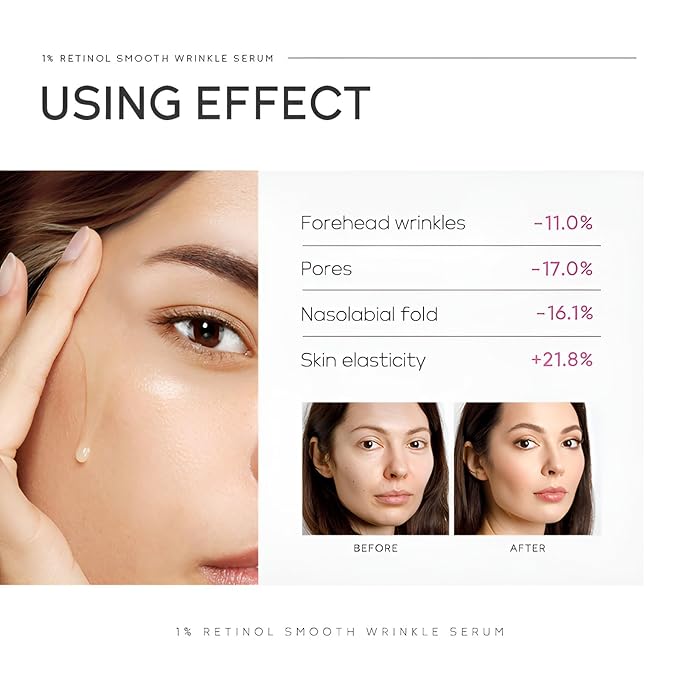 1% Retinol Serum for Face, Facial Serums for Anti Aging with Retinol, Niacinamide & Vitamin E for Fine Lines, Wrinkles & Dark Spots, Daily Skincare to Smooth & Firm Skin, 1.06 fl. oz, Pack of 2-FemmiqueWomen