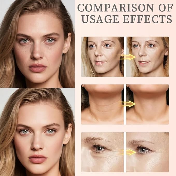 Xianjina Polypeptide Collagen Elastic Essence Cream - Micro-Molecular Anti-Wrinkle Firming Lotion, Tightening & Lifting Sagging Skin for Face, Moisturizing Anti-Aging Treatment (2 Pack)-FemmiqueWomen