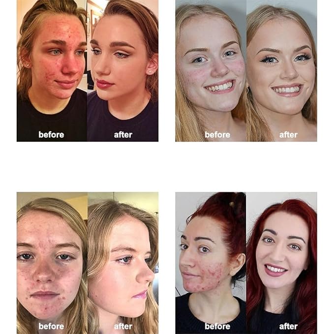 2 Pack PHOERA Foundation 106 Warm Sun Makeup,Full Coverage Foundation for Women and Girls-FemmiqueWomen