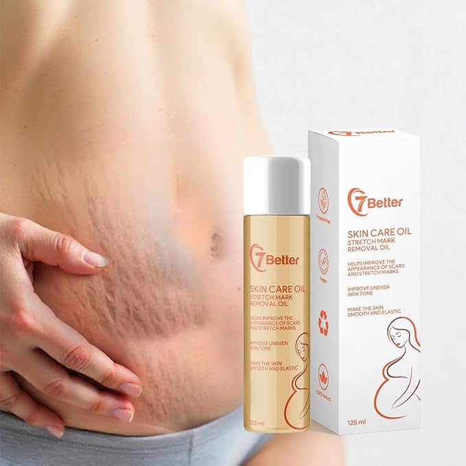 Stretch Mark Pregnancy Oil, Natural Oil Skincare Body Oil Serum for Scars and Stretch Marks, Face with Vitamin E & A for Sensitive Dry Skin and Body Moisturizer-FemmiqueWomen