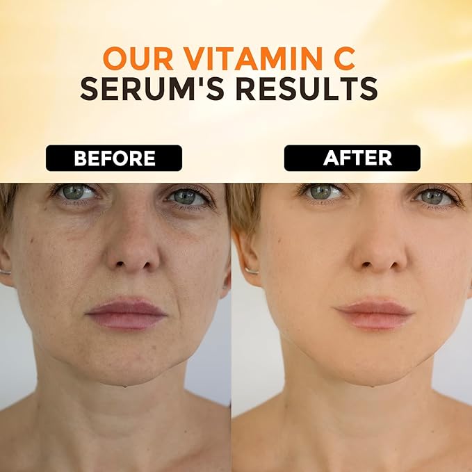2 Packs Vitamin C Serum for Face –Anti Aging Face & Eye Serum, Hyaluronic Acid, Reduce Fine Lines, Dark Spots and Wrinkle-FemmiqueWomen