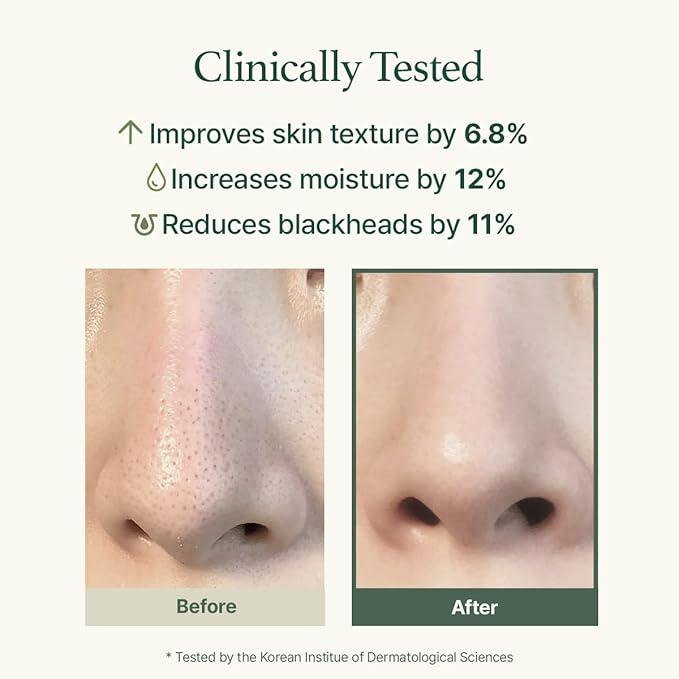 Korean Rice Mochi Face Cleanser - Face Mask, Foaming Cleanser, Gentle Scrub All in One - Deep Cleansing, Moisturizing, Pore Minimizing, Removing Blackhead- with Rice Water & Green Tea, Mugwort-FemmiqueWomen