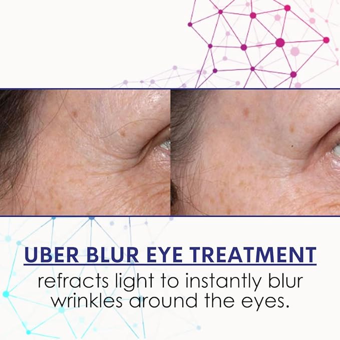 3D Eye Treatment-FemmiqueWomen