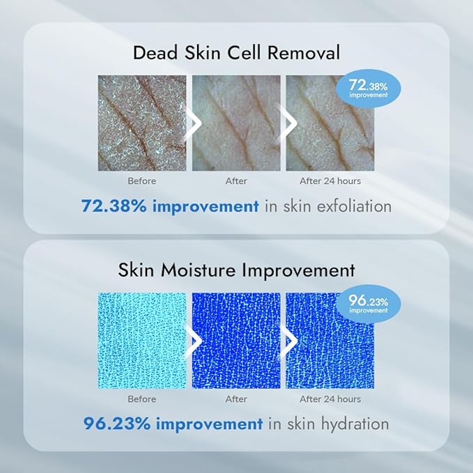 V11FACTORY AHA 12% Glycolic Acid Body Lotion – Korean Exfoliating & Hydrating Body Cream with Hyaluronic Acid & Collagen – Unscented, Paraben-Free Skin Smoothing Moisturizer, 10.6 oz-FemmiqueWomen