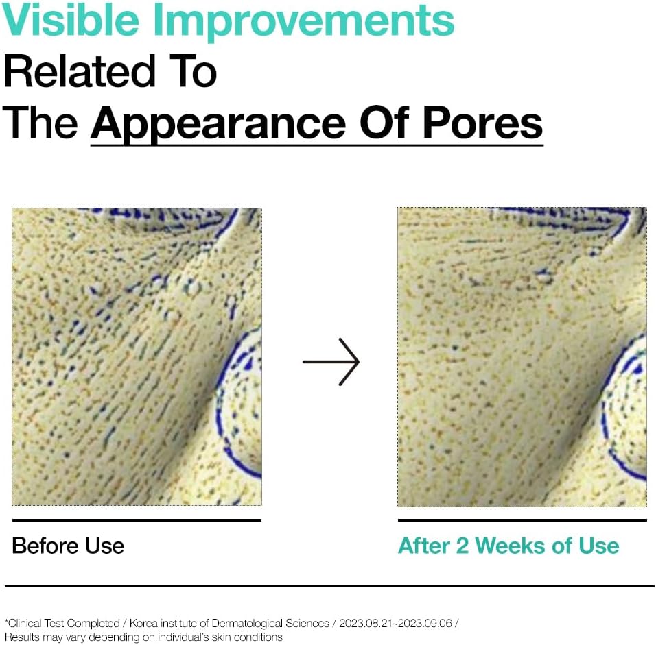 ANUA BHA 2% Gentle Exfoliating Toner, Mild Facial Exfoliant, Salicylic Acid for Pores and Sebum, Teatree Extract, Hyaluronic Acid, Ceramides (150ml / 5.07 fl.oz.)-FemmiqueWomen