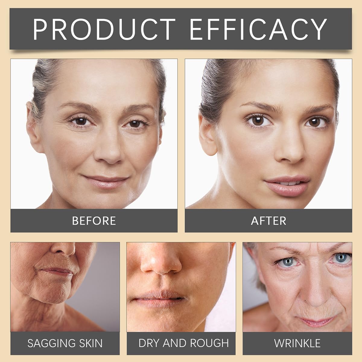 Bee Venom Moisturiser Cream Wrinkle Removal & Firming, Anti-Aging Eye&Face Bee Venom Skin Treatment Cream, Natural And Non-Irritating, Lifting & Recovery For All Skin Type (3 Packs, 60g)-FemmiqueWomen