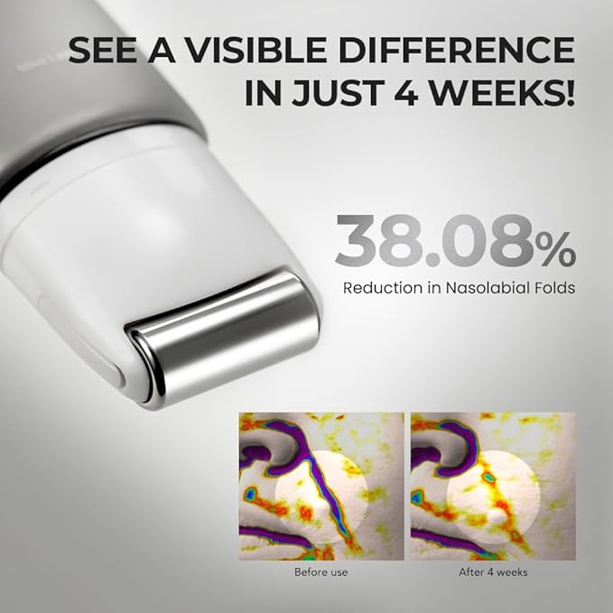 [SKIN&LAB] Retinol Lifting Roller Cream with Massage applicator, Vegan Anti Aging Face and Neck Cream for Reduce Wrinkles and Fine Line, For Face, Neck, Décolleté Wrinkle Care, 1.69 fl. oz.-FemmiqueWomen