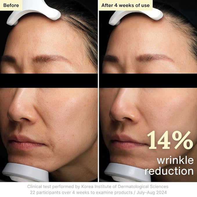 Rothea Resilience Cream, Anti-Aging with Bakuchiol 10,000ppm (Natural Retinol Alternative), Face Moisturizer, Neck Cream with Collagen, Ceramides, Peptides, Niacinamide, Korean Skin Care, 1.7 oz-FemmiqueWomen