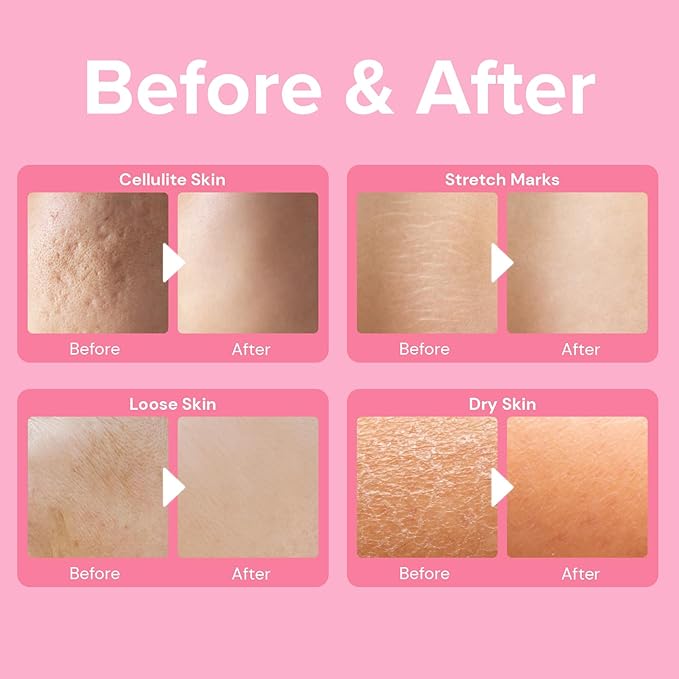 Enaskin Naturals Anti Cellulite Cream: Skin Firming and Tightening Lotion for Booty, Legs & Belly - Lifting Body Mask for Women Loose Skin, Lift & Firm Moisturizing Bum Bum Care-FemmiqueWomen