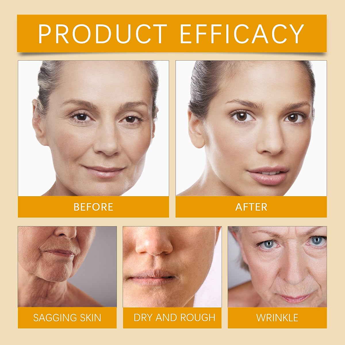 Bee Venom Moisturiser Cream Wrinkle Removal & Firming, Anti-Aging Eye & Face Bee Venom Skin Treatment Cream (3 Packs, 0.71Oz)-FemmiqueWomen