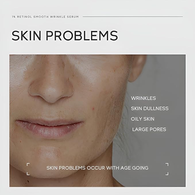 1% Retinol Serum for Face, Facial Serums for Anti Aging with Retinol, Niacinamide & Vitamin E for Fine Lines, Wrinkles & Dark Spots, Daily Skincare to Smooth & Firm Skin, 1.06 fl. oz, Pack of 2-FemmiqueWomen