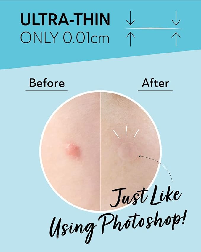 Invisible Salicylic Acid Pimple Patches for Face - Redness Reducing Hydrocolloid Acne Patches, Clear Pimple & Zit Patches for Blind Pimples - Soothing Plus (Clear Patch) (Intensive-36dots-2)-FemmiqueWomen