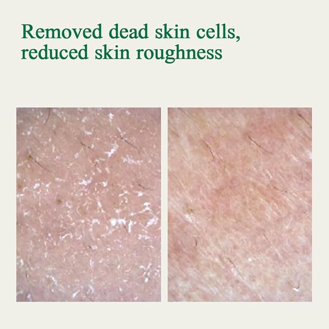 [PKY] Pyunkang Yul Ultimate Calming Solution Toner with Honeysuckle Flower, Ceramides, Hyaluronic Acid, Centella Asiatica, for Moisturized, Nourishing, Sensitive, Tired Facial Skin 3.71fl.oz.-FemmiqueWomen