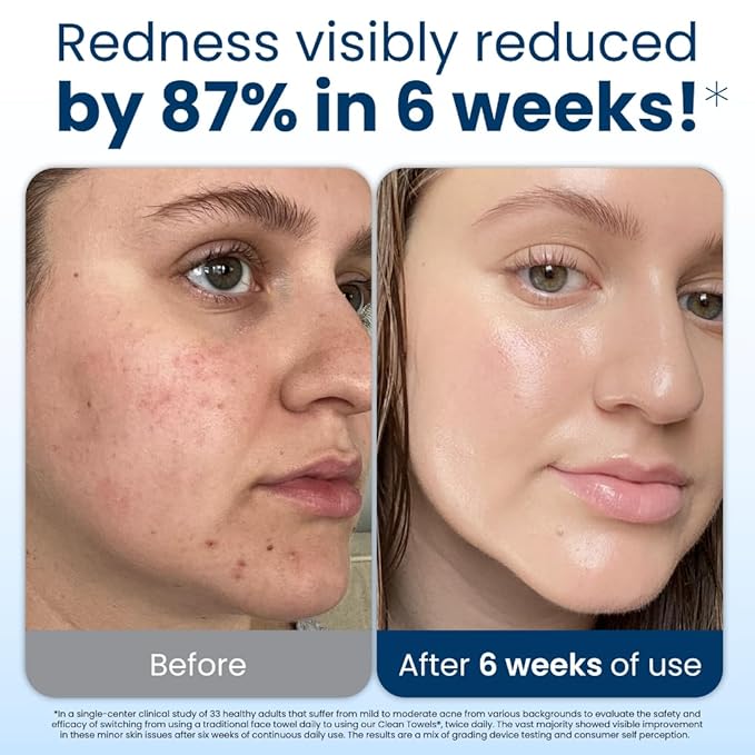 Clean Skin Club Clean Towels XL™, 100% USDA Biobased Face Towel, Disposable Face Towelette, Makeup Remover Dry Wipes, Ultra Soft, 50 Ct, 1 Pack-FemmiqueWomen