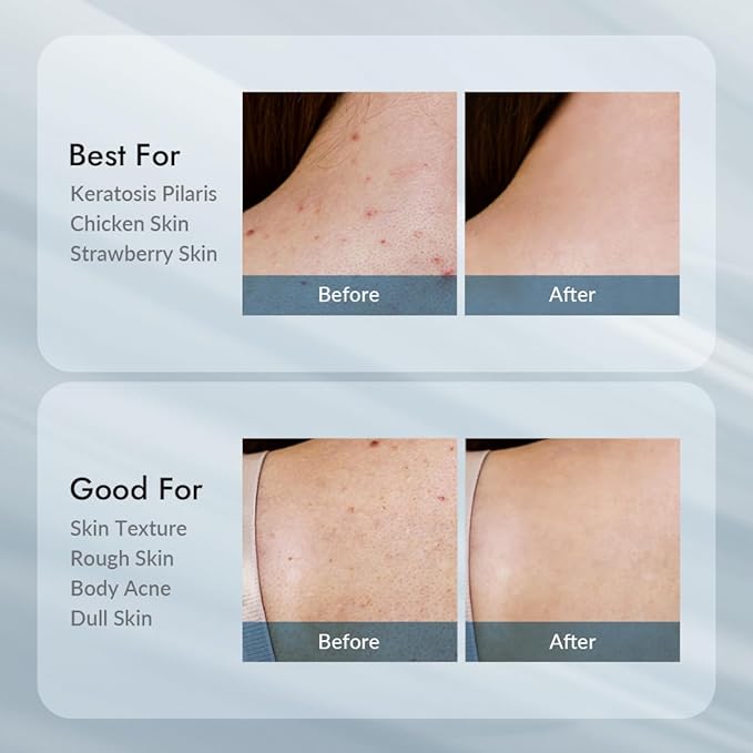 V11FACTORY AHA 12% Glycolic Acid Body Lotion – Korean Exfoliating & Hydrating Body Cream with Hyaluronic Acid & Collagen – Unscented, Paraben-Free Skin Smoothing Moisturizer, 10.6 oz-FemmiqueWomen