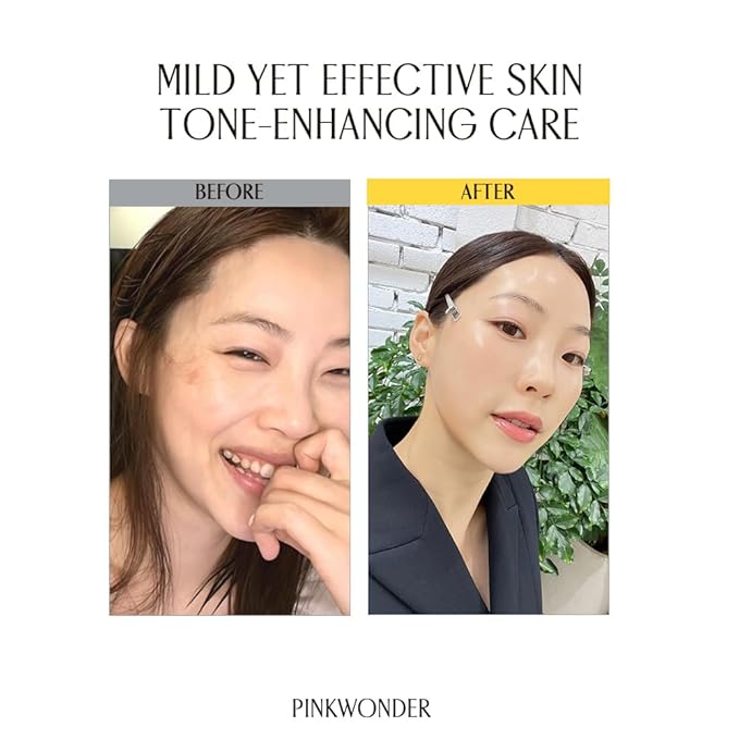 PINKWONDER Neroli Serum 1.01oz (30ml), Niacinamide and Neroli Extract for Glowing Skin, Improve Uneven Skin Tone, Hydrating and Radiance, Suitable for Sensitive Skin, Korean Skincare