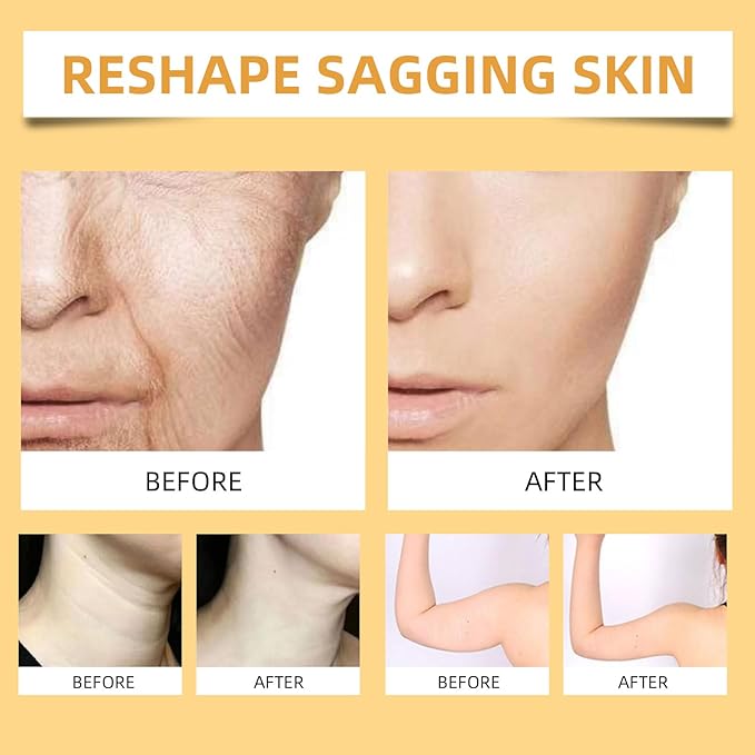 Bee Venom Firming Serum Stick, 2PCS Anti-Aging Face Cream, Lifts and Tightens the Skin, Hydrating, Lifting & Restoring Skin Elasticity, Bee Venom Body Tightening Cream for Women & Men-FemmiqueWomen