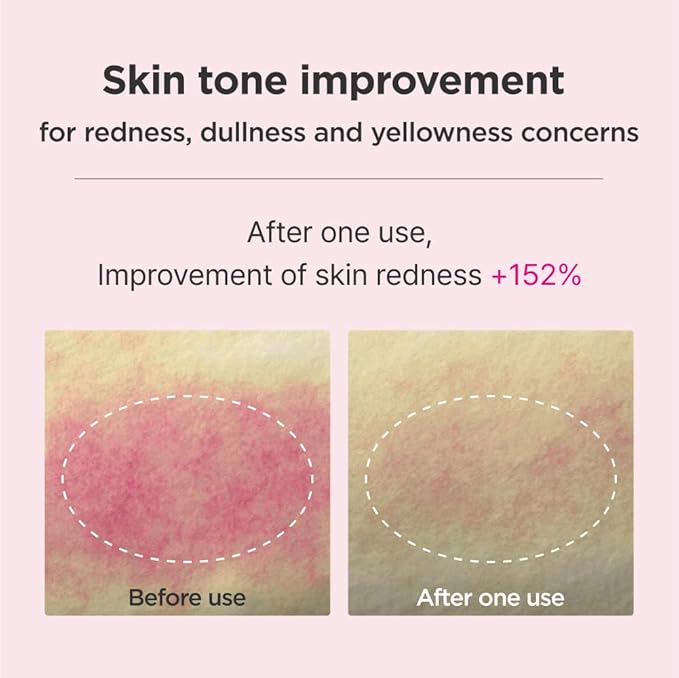 ISOI Blemish Care Up Serum Gift Set, Korean Skin Care for Hydration & Radiance – Full Size or 5-Step Travel Kit Options (5-Step Special Kit (1.77 fl.oz))-FemmiqueWomen