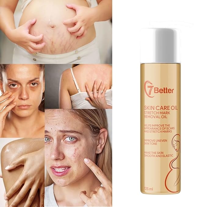 Stretch Mark Pregnancy Oil, Natural Oil Skincare Body Oil Serum for Scars and Stretch Marks, Face with Vitamin E & A for Sensitive Dry Skin and Body Moisturizer-FemmiqueWomen