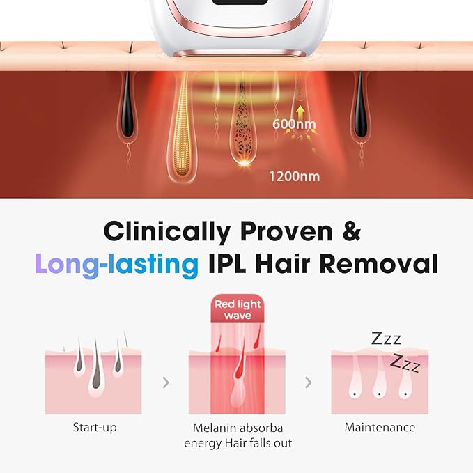 IPL Laser Hair Removal Device for Women & Men - Home 45°F Ice-Cooling Contact for Painless & Long-Lasting Results, 86% Hair Reduction in 3 Weeks for Full Body & Bikini Line, White-FemmiqueWomen