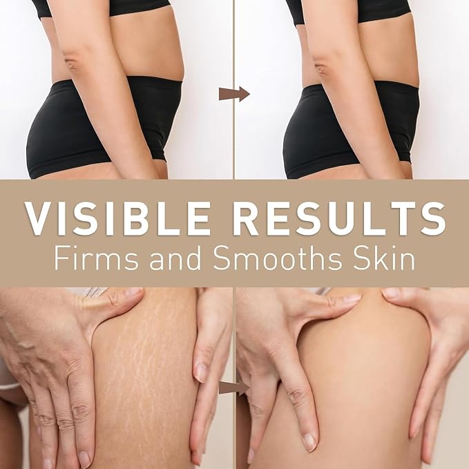 Belly Firming Cream for Tightening & Cellulite – Skin Firming Cream for Stomach, Thighs & Butt – Moisturizing & Lifting Body Lotion for Women-FemmiqueWomen