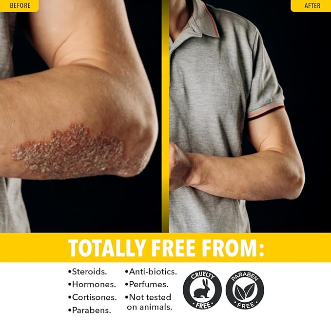 Dr. Robaina Sulfur Balsam Lotion – Lightweight Moisturizer for Dry, Flaky & Itchy Skin – Calms Redness, Supports Skin Barrier & Locks Hydration – Shea Butter & Tea Tree – 8 fl oz, USA Made-FemmiqueWomen