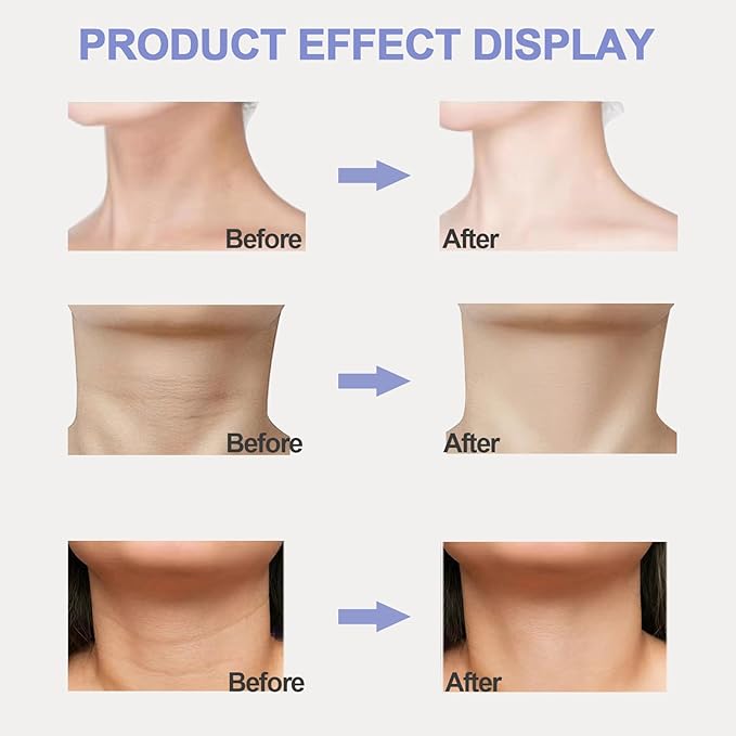 Neck Firming Cream, Neck Tightening Cream, Tighten and Lift Neck Cream, Neck Creams for Tightening and Firming Sagging Skin, Help Reduce Fine Lines & Wrinkles-FemmiqueWomen