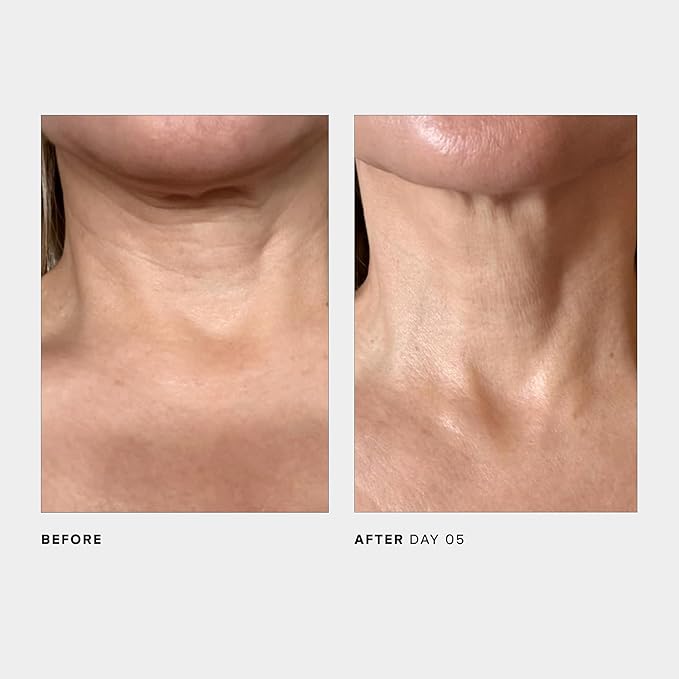 U Beauty The SCULPT Neck + Décolleté Concentrate-FemmiqueWomen