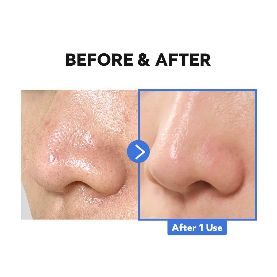 TIRTIR Hydro Boost Enzyme Cleansing Balm (1.69 Ounce (Pack of 1))-FemmiqueWomen