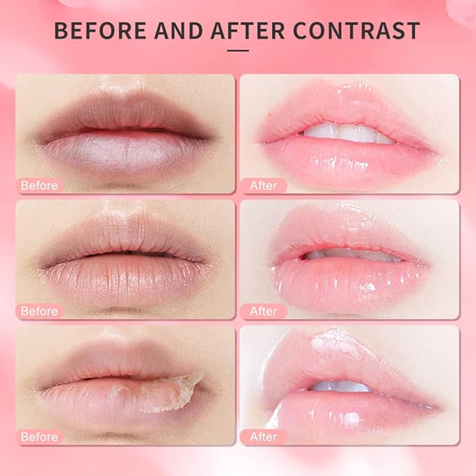 Lip Scrub, Lip Scrubs Exfoliator Moisturizer Dr.YIMAN Sugar Lip Scrub, Lip Exfoliator Scrub for Dry and Chapped Lips,Anti-Aging and Temping, Lip Mask, Lip Care Products, Lip Scrubber, Lip Moisturizer-FemmiqueWomen