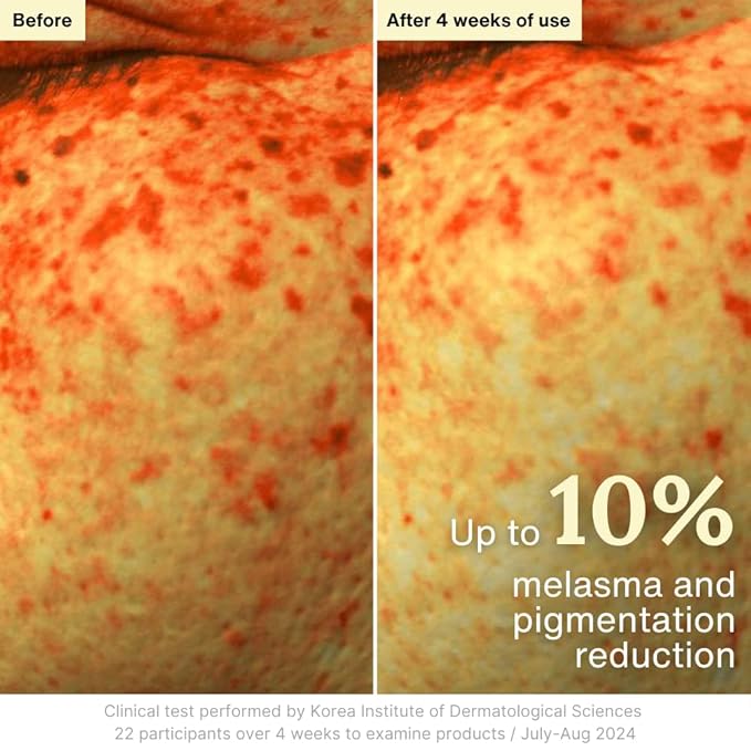 Rothea Resilience Cream, Anti-Aging with Bakuchiol 10,000ppm (Natural Retinol Alternative), Face Moisturizer, Neck Cream with Collagen, Ceramides, Peptides, Niacinamide, Korean Skin Care, 1.7 oz-FemmiqueWomen