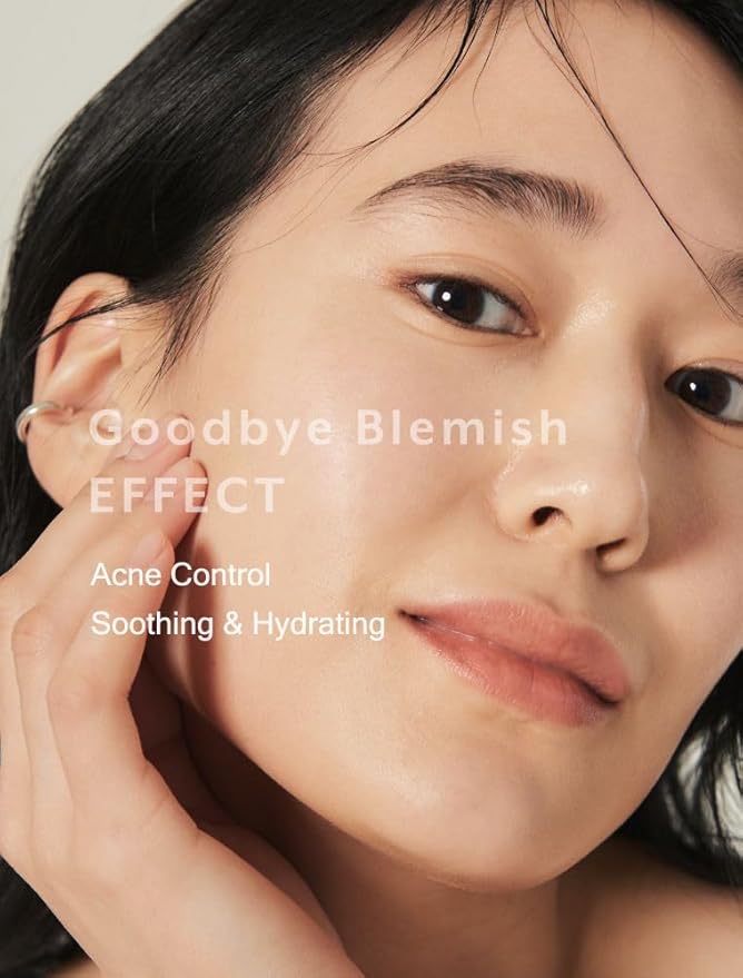 MIZON Goodbye Blemish Fresh Toner, BHA, Niacinamide for Excessive Sebum, Troubled Skin, Acne Treatment, Breakout Treatment, Korean Skincare, Acne Spot Treatment, Smooth Skin (120ml/4.05 fl. oz.)-FemmiqueWomen