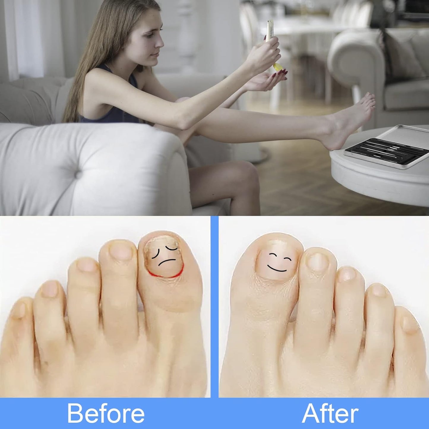 Ingrown Toenail Tool Removal Tool Kit, 10PCS Surgical Stainless Steel Professional Ingrown Toenail File and Lifters Manicure Care Treatment for Nail Correction Under Sidewall Clean-FemmiqueWomen