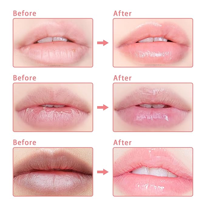 3 Pcs Bee Lip Balm Honey Pot, Coconut Watermelon Apple Lime Lip Mask Overnight, Moisturizing Lip Sleeping Mask, Hydrate Repair Prevent Dry Cracked Lip Exfoliator (Coconut +Watermelon+Apple Lime)-FemmiqueWomen