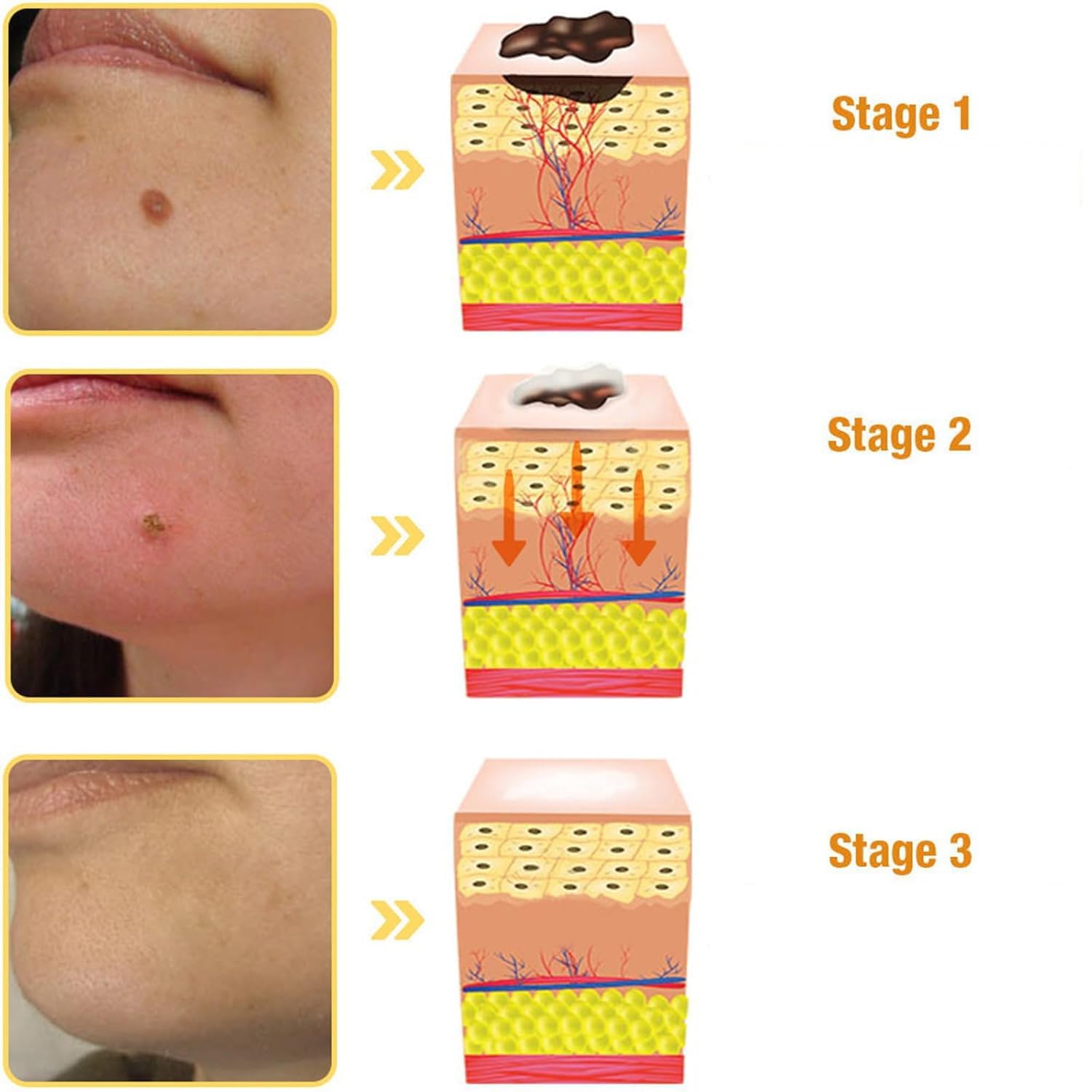 Bee Venom Cream, Professional Bee Venom Cream, Bee Venom Repair Cream for All Parts of The Body (2 Pack)-FemmiqueWomen