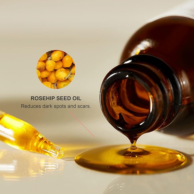 100% PURE Organic Rosehip Oil Moisturizer For Face, Body, Hair Hydrating Vitamins & Omega Fatty Acids Support Glowing, Plumped Up Youthful Skin - Natural Cold-Pressed Facial Radiance - Vegan - 1oz-FemmiqueWomen