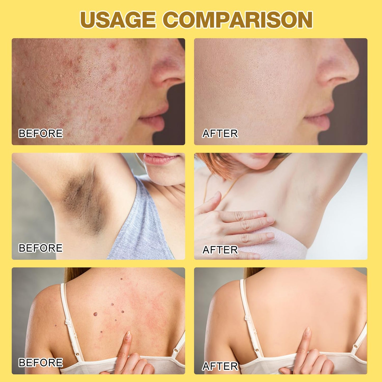 Bee Venom Treatment, New Professional Bee Venom Repair Cream,Bee Venom Moisturizing Gel, Natural Bee Venom Repair Cream, for All Types (2pcs)-FemmiqueWomen