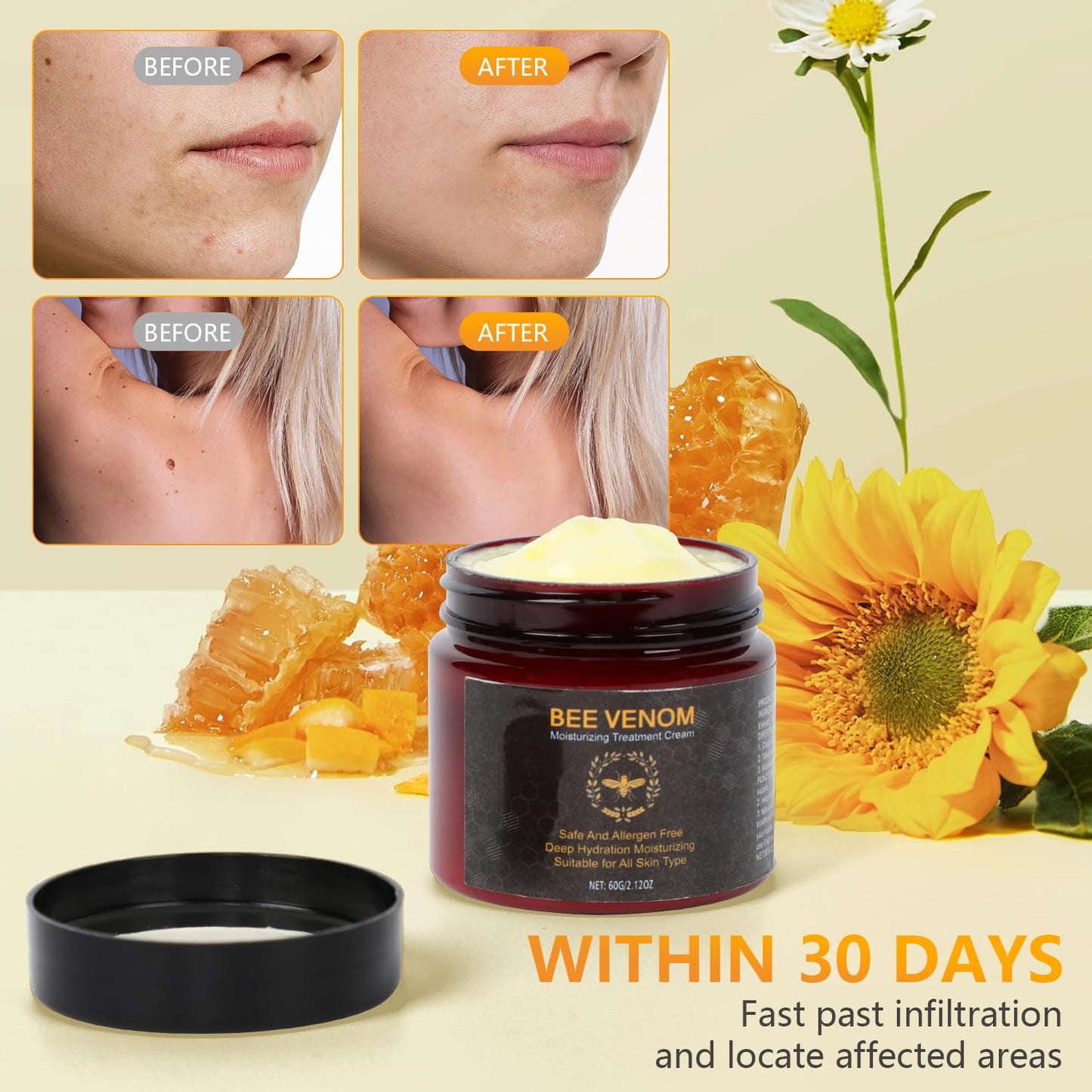 2 PCS Bee Venom Cream, 2025 New Bee Venom Skin Repair Cream for All Skin Types-FemmiqueWomen