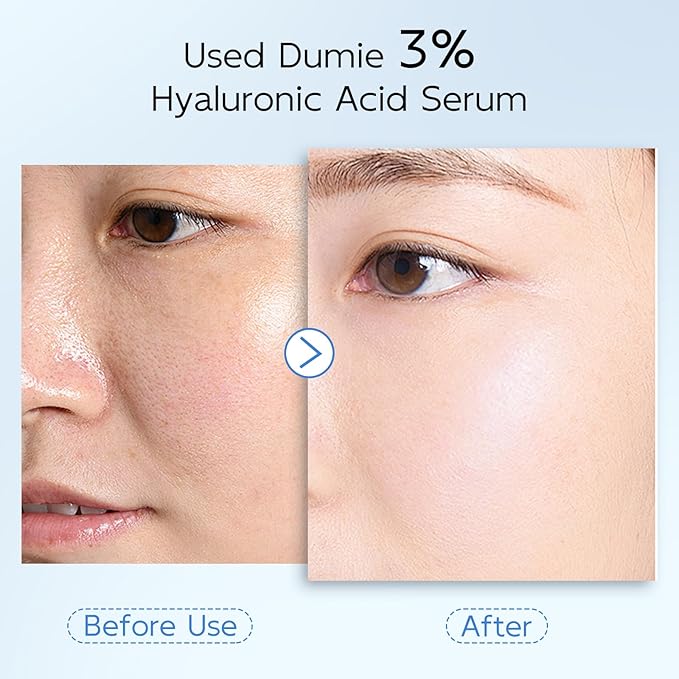 3% Hyaluronic Acid Serum for Face, Anti-Aging Hydrating Serum with 20,000 ppm Ceramide NP & 10,000ppm Acetyl Hexapeptide-8, Korean Skincare ultra hydrating serum, turm Skin/Sensitive Skin(1.5 ml*30)-FemmiqueWomen